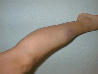 leg2.gif (19356 oCg)